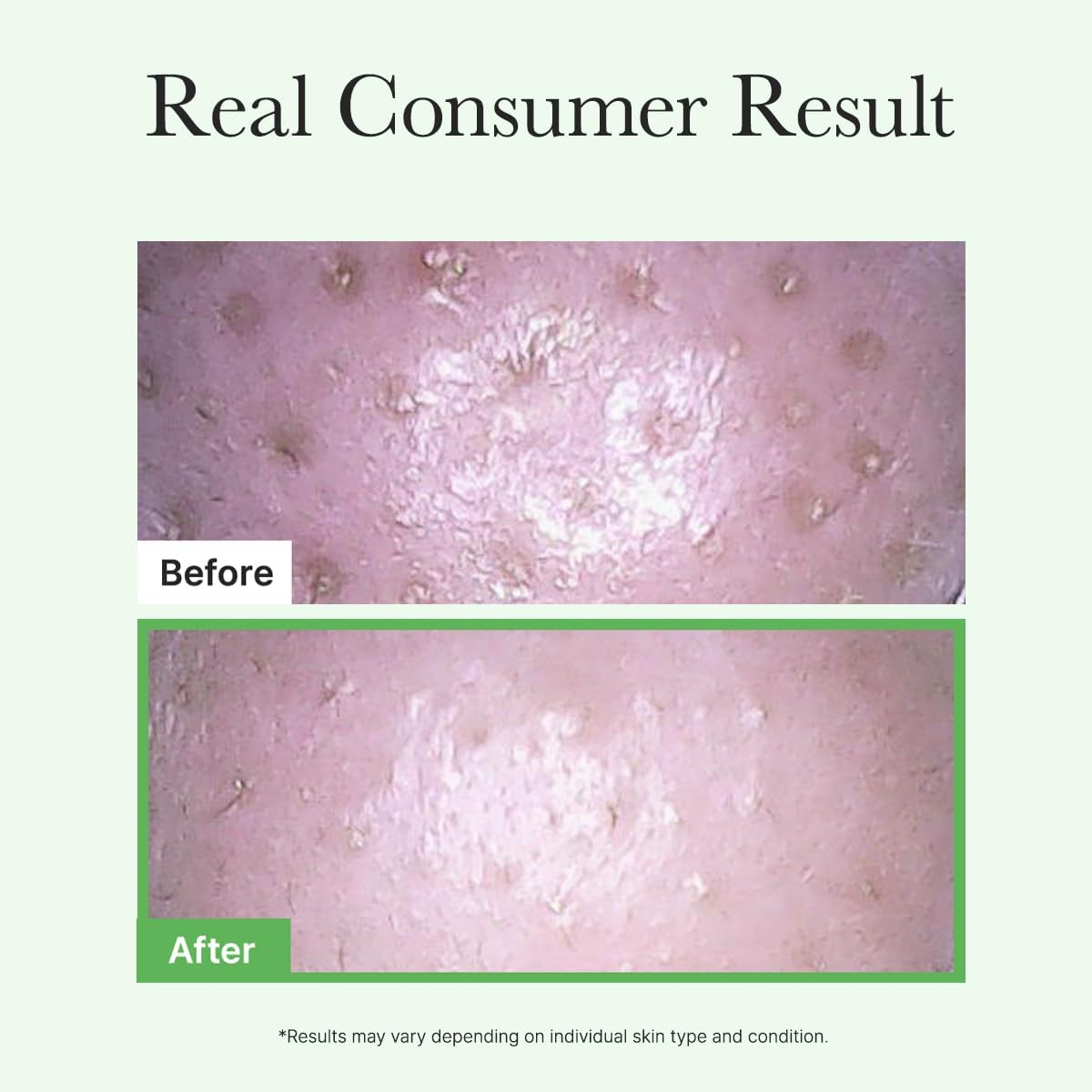 Arencia Pore Melt Mochi Cleansing Oil application on face