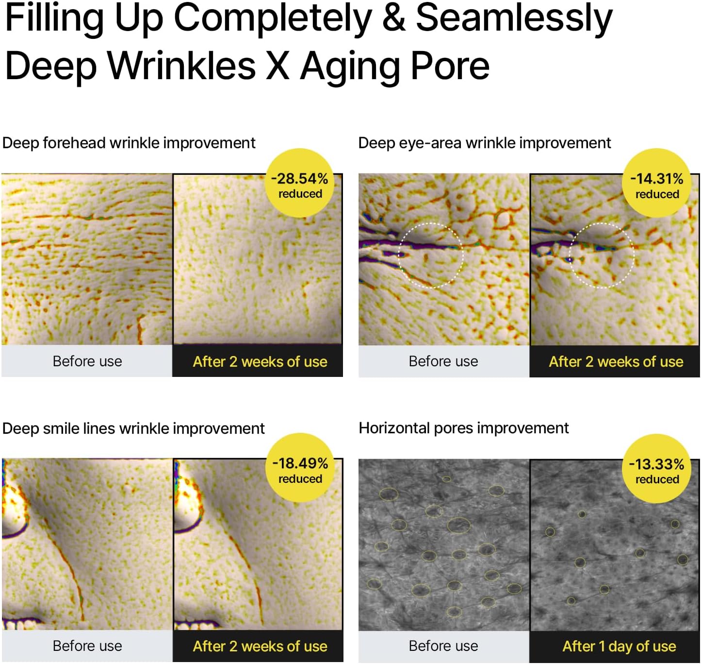 Celimax Retinal Shot Tightening Booster — anti-wrinkle pore minimizer benefits