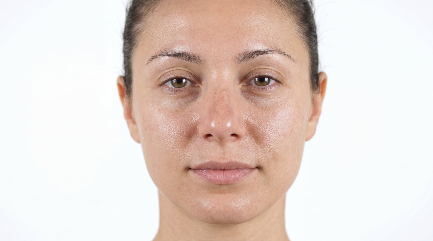 image comparison before